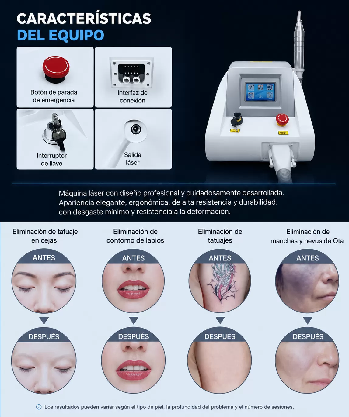 Removedora de tatuajes 5